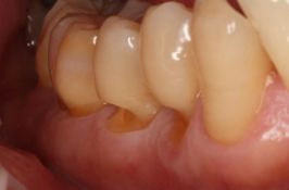 Salud periodontal y cuidado integral de encías