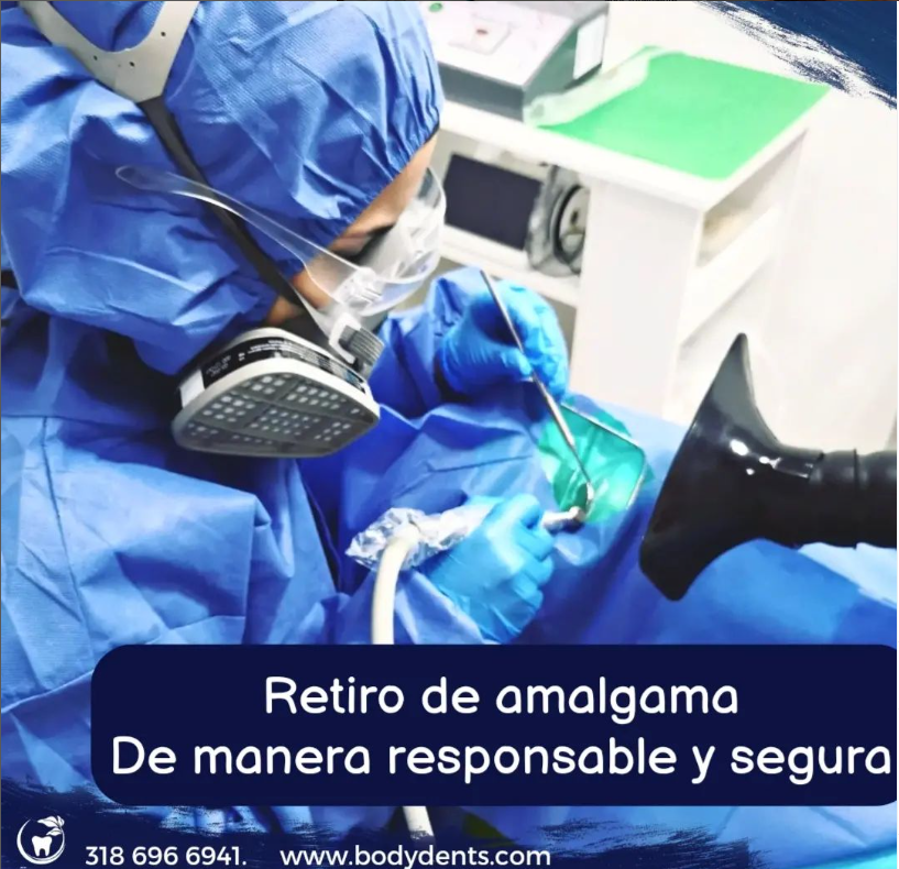 Retiro responsable de restauraciones de amalgama