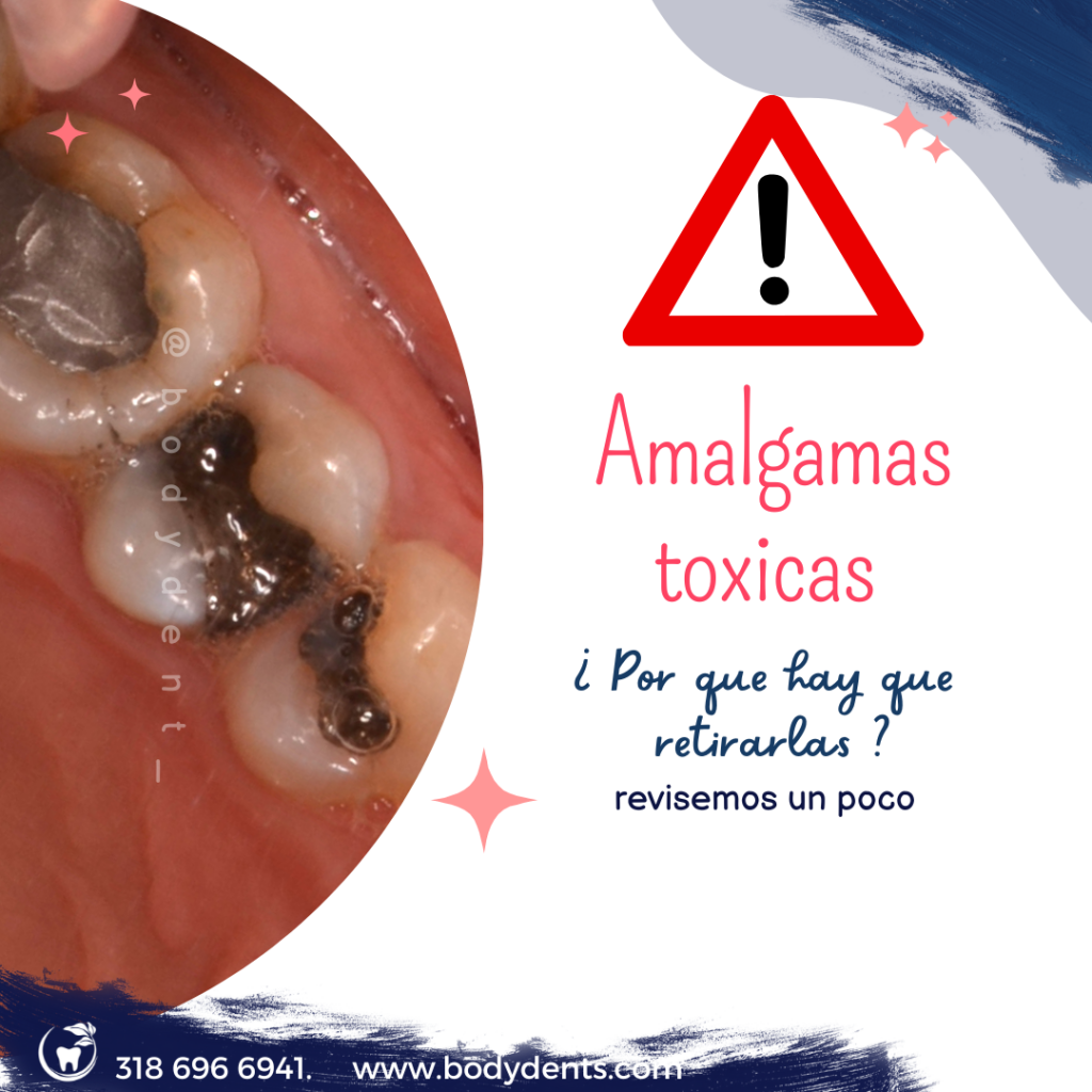 toxicidad de las amalgamas