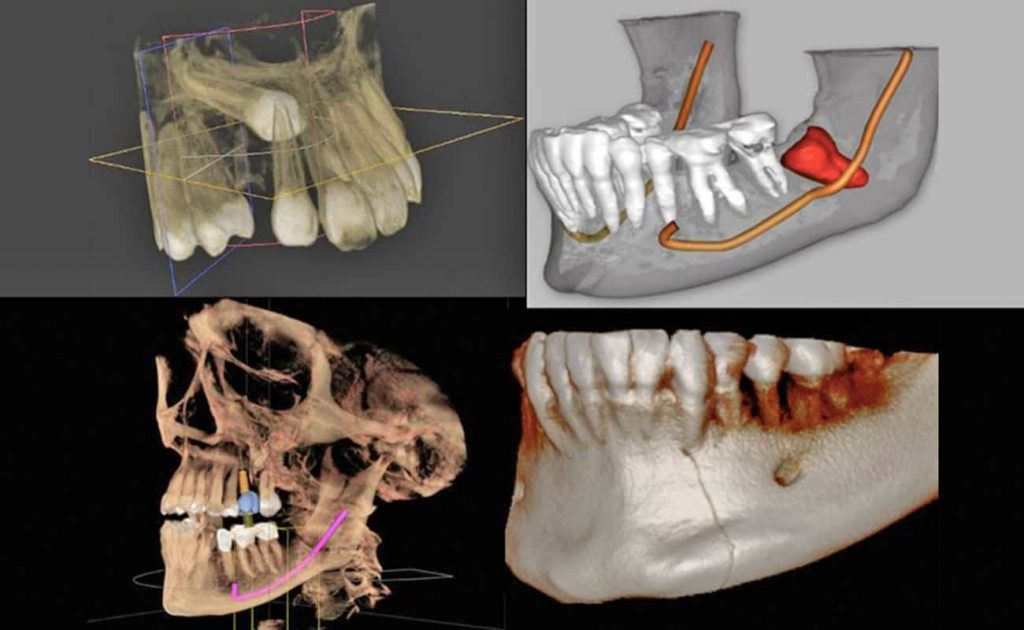 cone beam dental