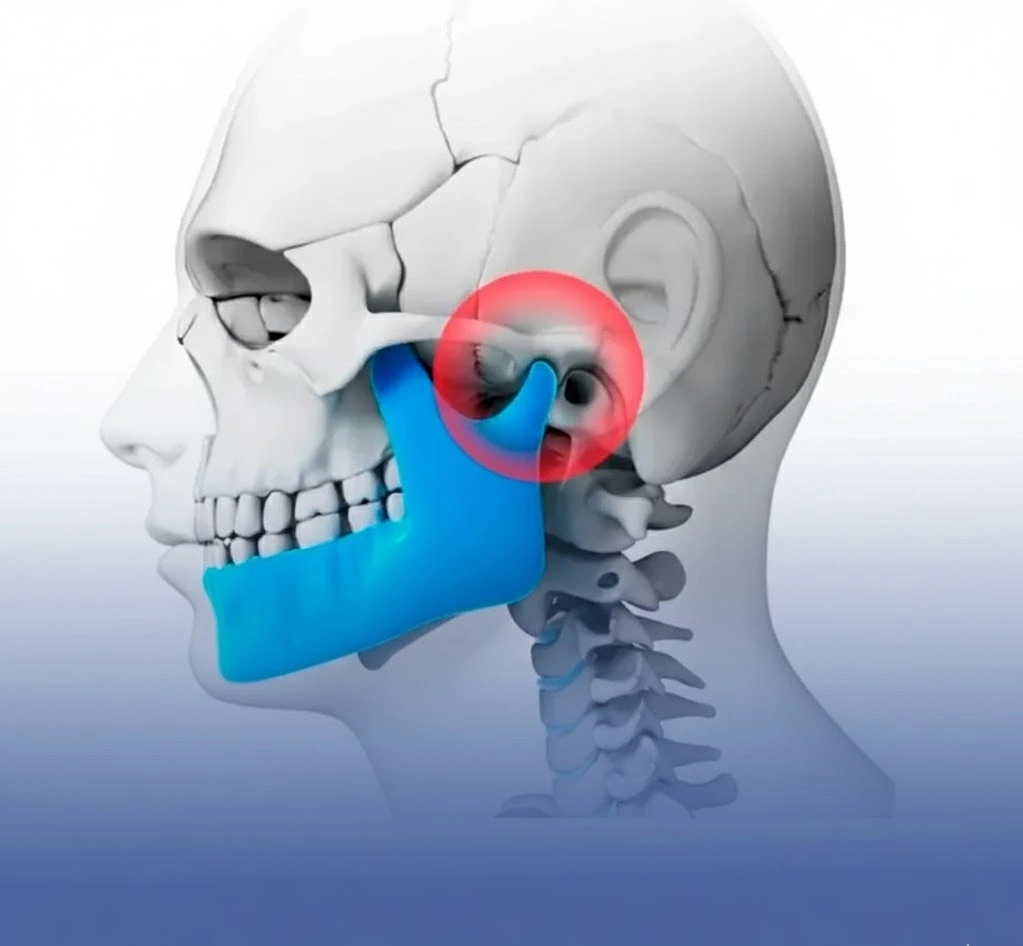 Valoración de ATM y complejo cráneo-cérvico-mandibular